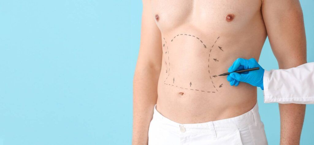 Marking out cosmetic surgery for men